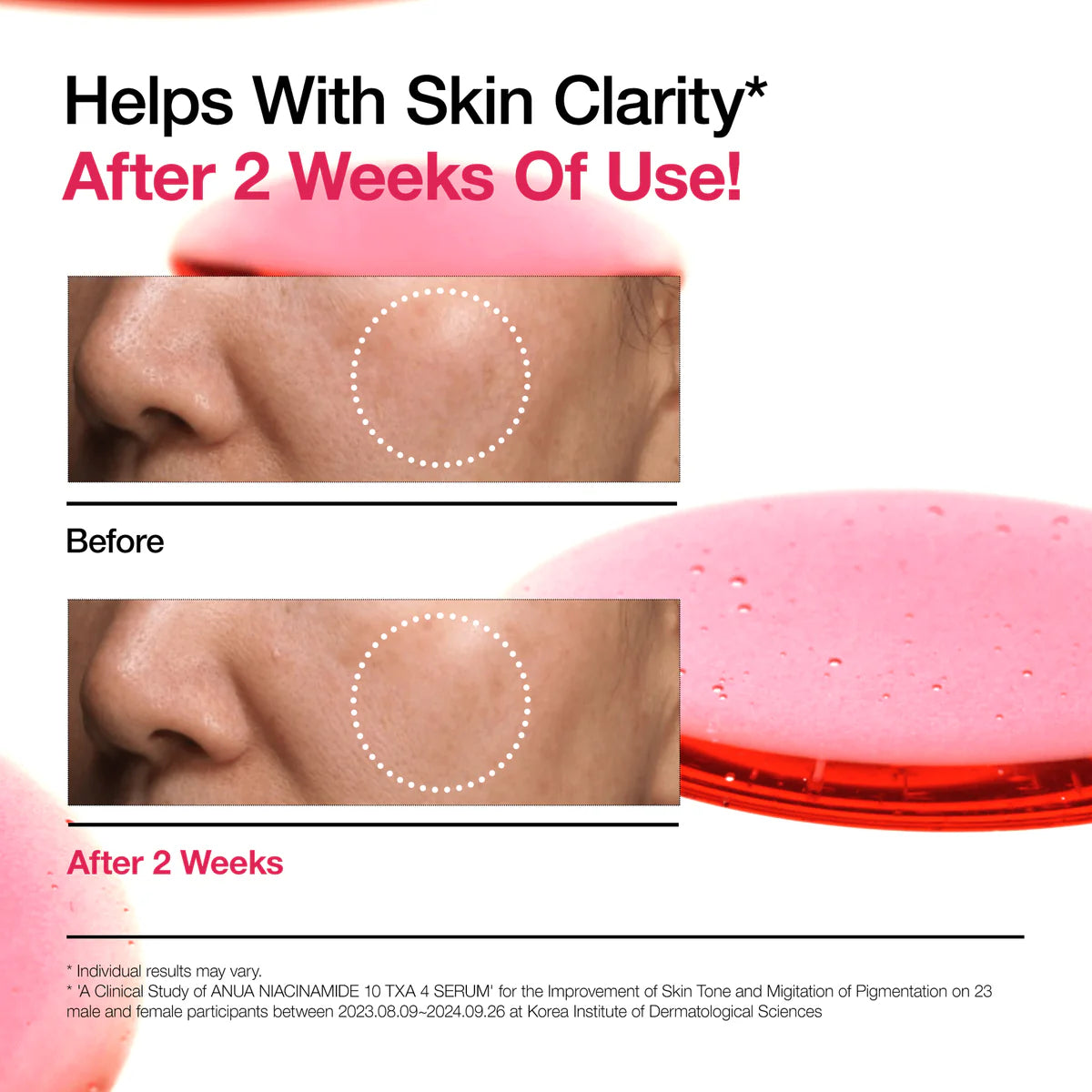 Anua-NIACINAMIDA 10%+TXA 4% Serum